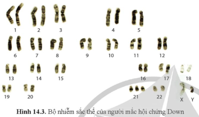 Giải Sinh học 12 Bài 14 (Cánh diều): Di truyền học người (ảnh 1)