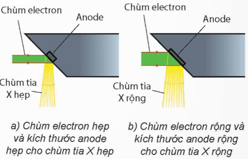 Dựa vào Hình 1.12 giải thích hoạt động của hệ thống làm tăng độ sắc nét của ảnh chụp bằng tia X