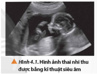 Trong y học, kĩ thuật chẩn đoán bằng sóng siêu âm (thường được gọi là kĩ thuật siêu âm hay siêu âm)