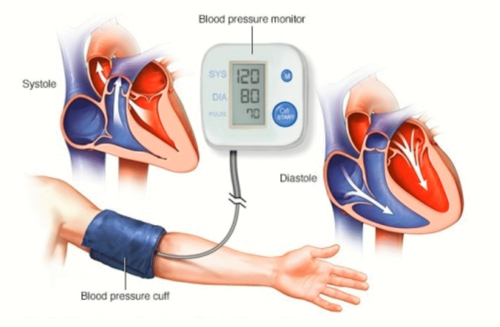 Độ giảm huyết áp của một bệnh nhân được cho bởi công thức 1